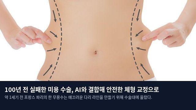 100년 전 실패한 미용 수술, AI와 결합해 안전한 체형 교정으로