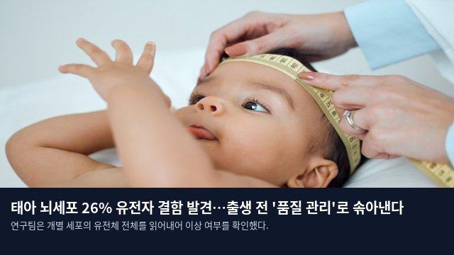 태아 뇌세포 26% 유전자 결함 발견…출생 전 '품질 관리'로 솎아낸다
연구팀은 개별 세포의 유전체 전체를 읽어내어 이상 여부를 확인했다.