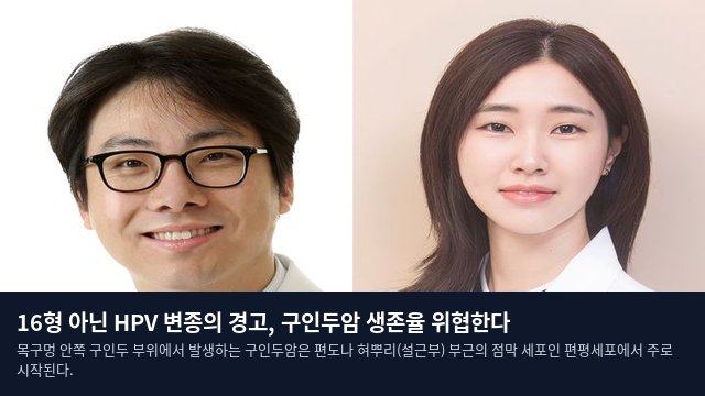 16형 아닌 HPV 변종의 경고, 구인두암 생존율 위협한다