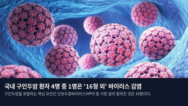 국내 구인두암 환자 4명 중 1명은 '16형 외' 바이러스 감염