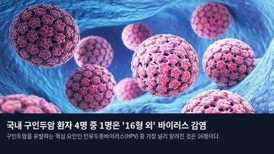 국내 구인두암 환자 4명 중 1명은 '16형 외' 바이러스 감염