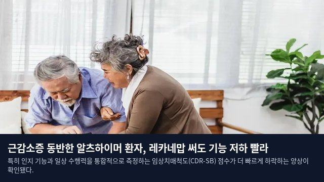 근감소증 동반한 알츠하이머 환자, 레카네맙 써도 기능 저하 빨라