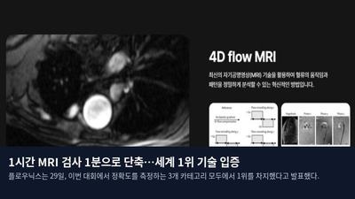 1시간 MRI 검사 1분으로 단축…세계 1위 기술 입증