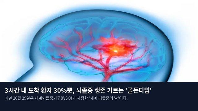 3시간 내 도착 환자 30%뿐, 뇌졸중 생존 가르는 '골든타임'